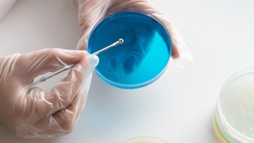 Тревожные находки: кишечная палочка в сети ресторанов "честных цен"