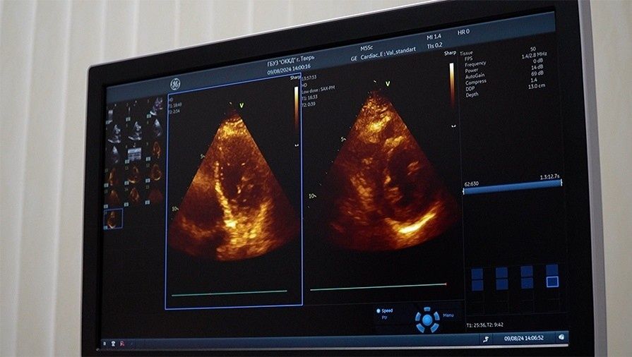 Увеличение печени: как лишний вес становится опасным для здоровья